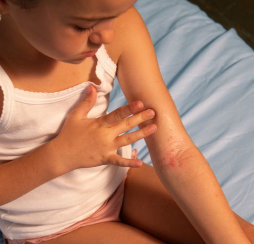Soins bébé et enfant peau à tendance atopique - Stelatopia