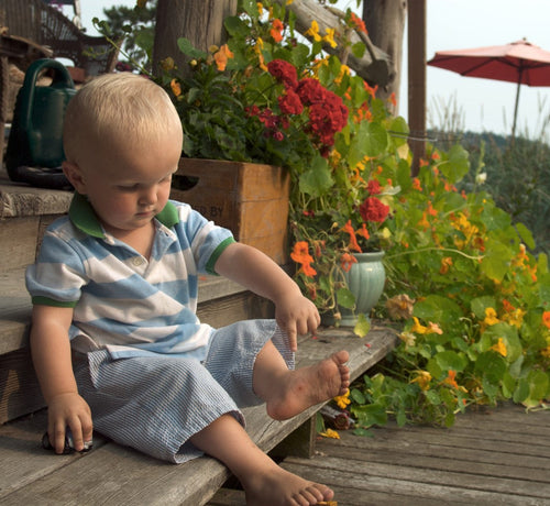 cicatrice chez le bébé ou l'enfant - Mustela France - 1