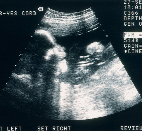 Mustela mode d’emploi pour une grossesse sans tabac - Mustela France - 1