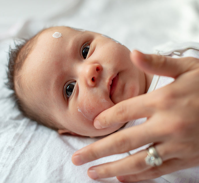 Les bienfaits des soins émollients sur la peau très sèche à tendance atopique des bébés