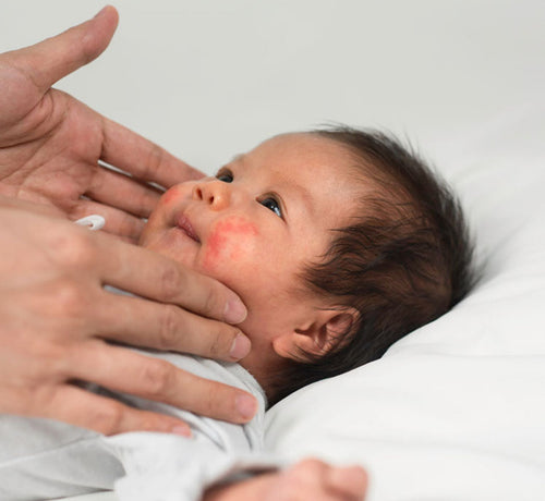 Mustela conseils d'application des soins - Mustela France - 1