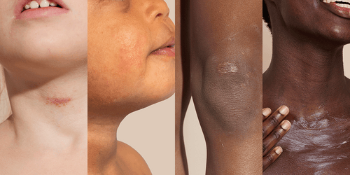 Couleurs de peau - Mustela France - 1