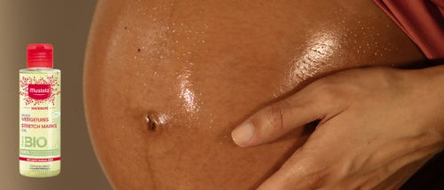 Le soin pour prévenir les vergetures 