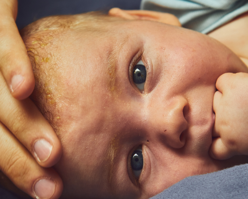 soins-nouveau-ne-mustela - Mustela France - 1